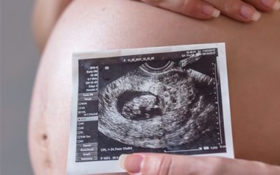 Cómo Indicarle al Médico que no deseas saber el sexo del Bebé y estás planeando tu Gender Reveal