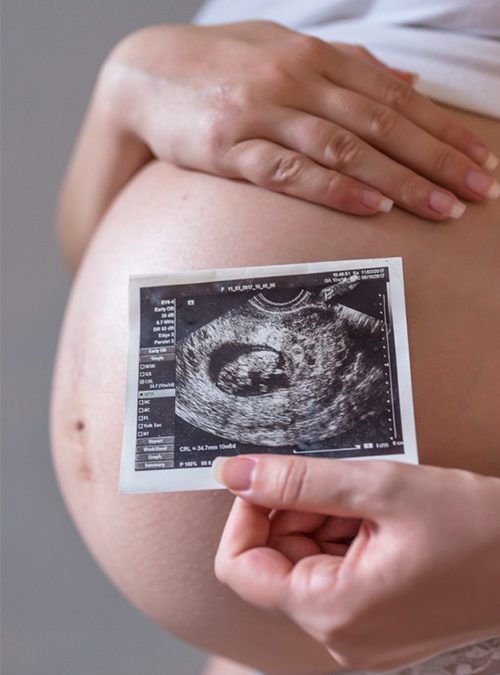 Cómo Indicarle al Médico que no deseas saber el sexo del Bebé y estás planeando tu Gender Reveal